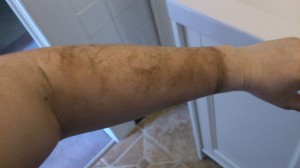 dirty arm